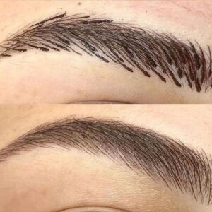 فیبروز ابرو طبیعی در کرج